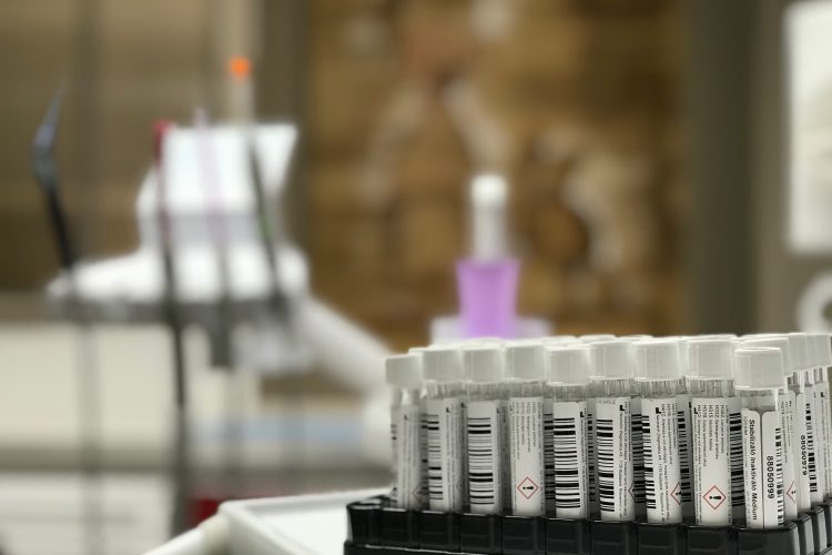 PCR teszt